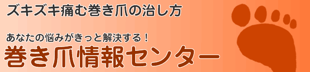 巻き爪は自宅で簡単に自分で治せます。巻き爪治療情報センター